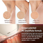 IPL Laser Hair Removal Machine for Women – Ice Cooling, Painless Hair Remover for Face & Body