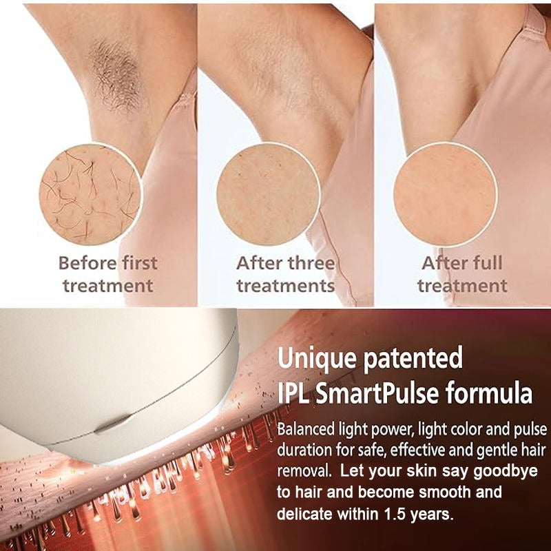 IPL Laser Hair Removal Machine for Women – Ice Cooling, Painless Hair Remover for Face & Body